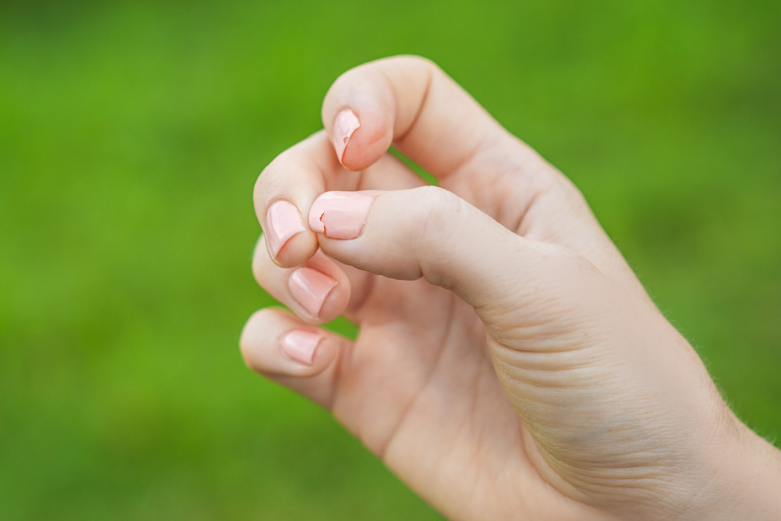 Broken nail on a woman's hand with a manicure on a green background