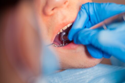 10 Places To Get Cheap Emergency Dental Care