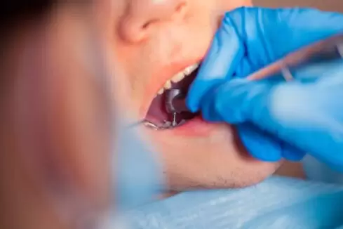 10 Places To Get Cheap Emergency Dental Care